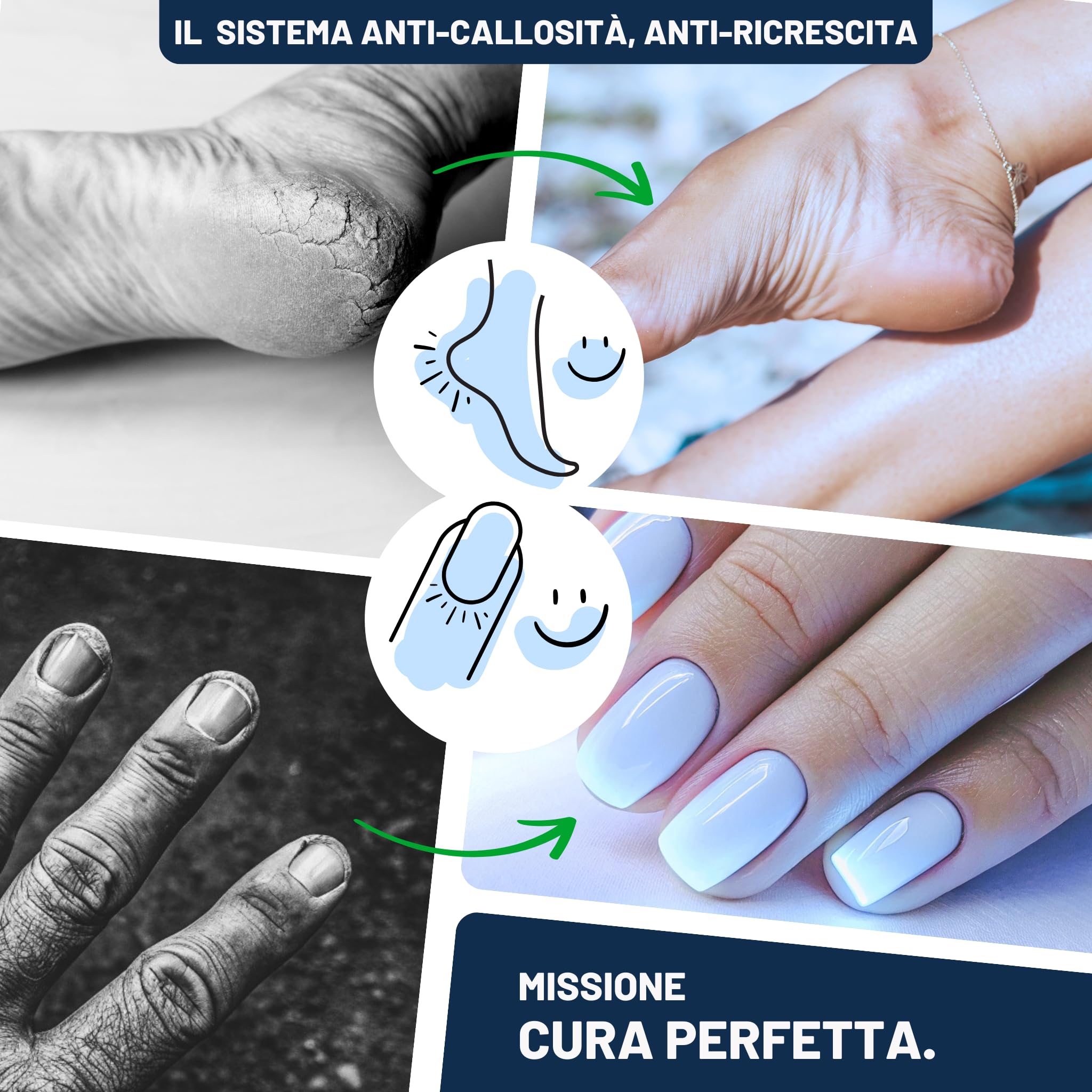 Mr. Fuss - Levacalli, soluzione attiva n° 4, 500 ml - calli piedi rimozione pedicure - cheratolitico piedi professionale