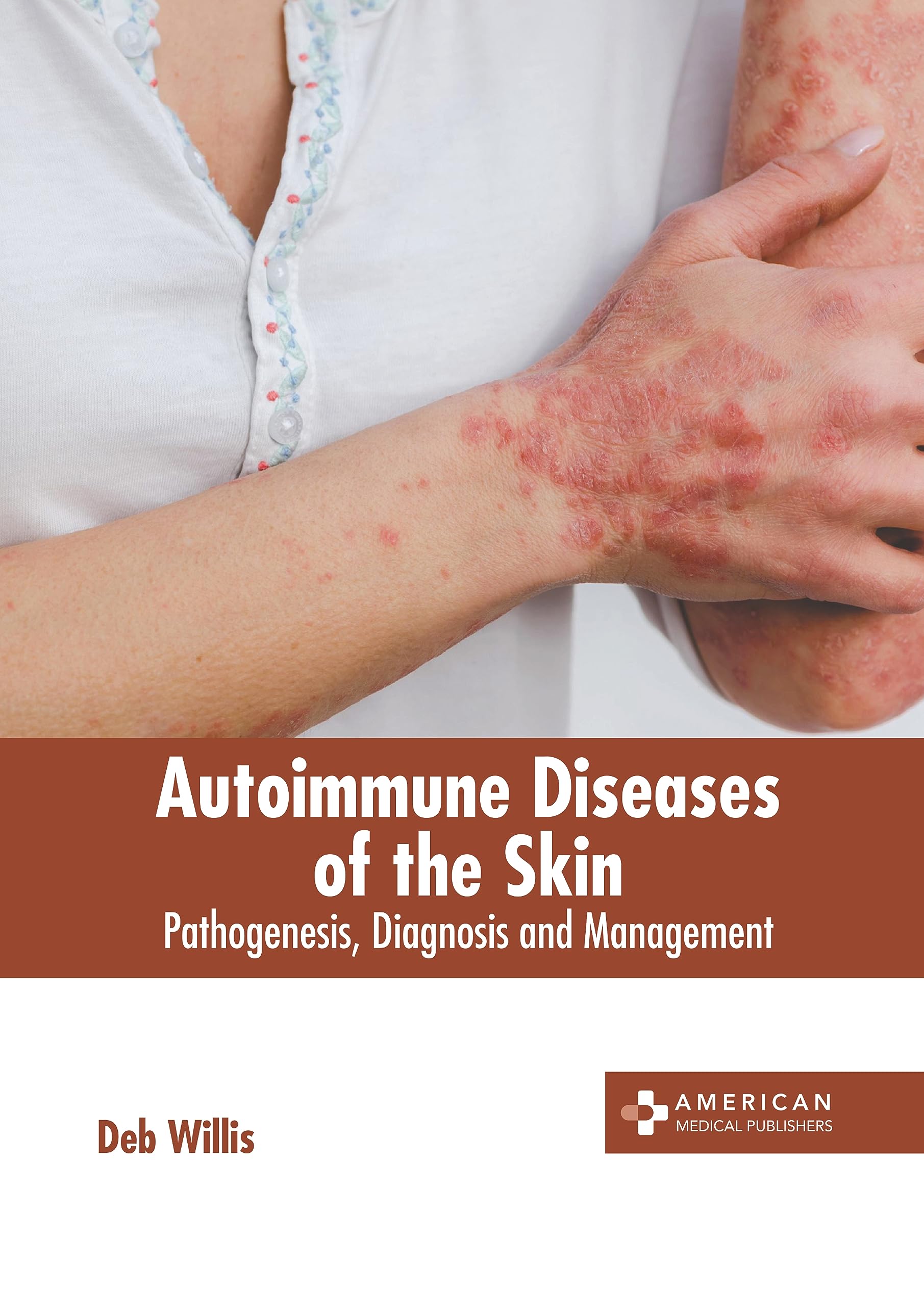 Autoimmune Skin Rashes 900x596