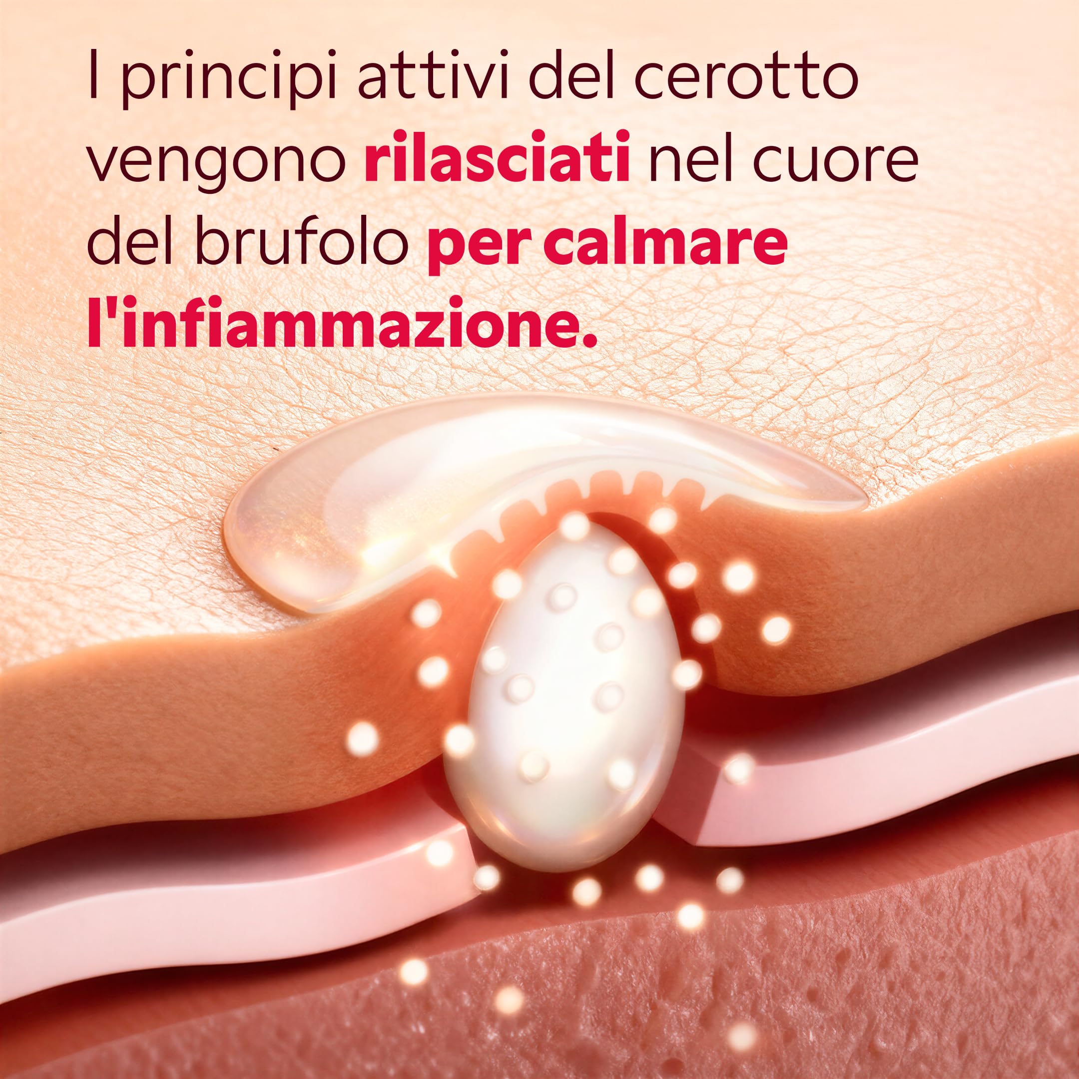 MY SOS BEAUTY Patch contro i brufoli micropunti – My SOS Beauty – Anti Acne Sotto Cutané – Acido salicilico & Albero del Tè – Elimina i brufoli dolorosi in 6 – 8 ore, invisibili e senza dolore, 9 patc