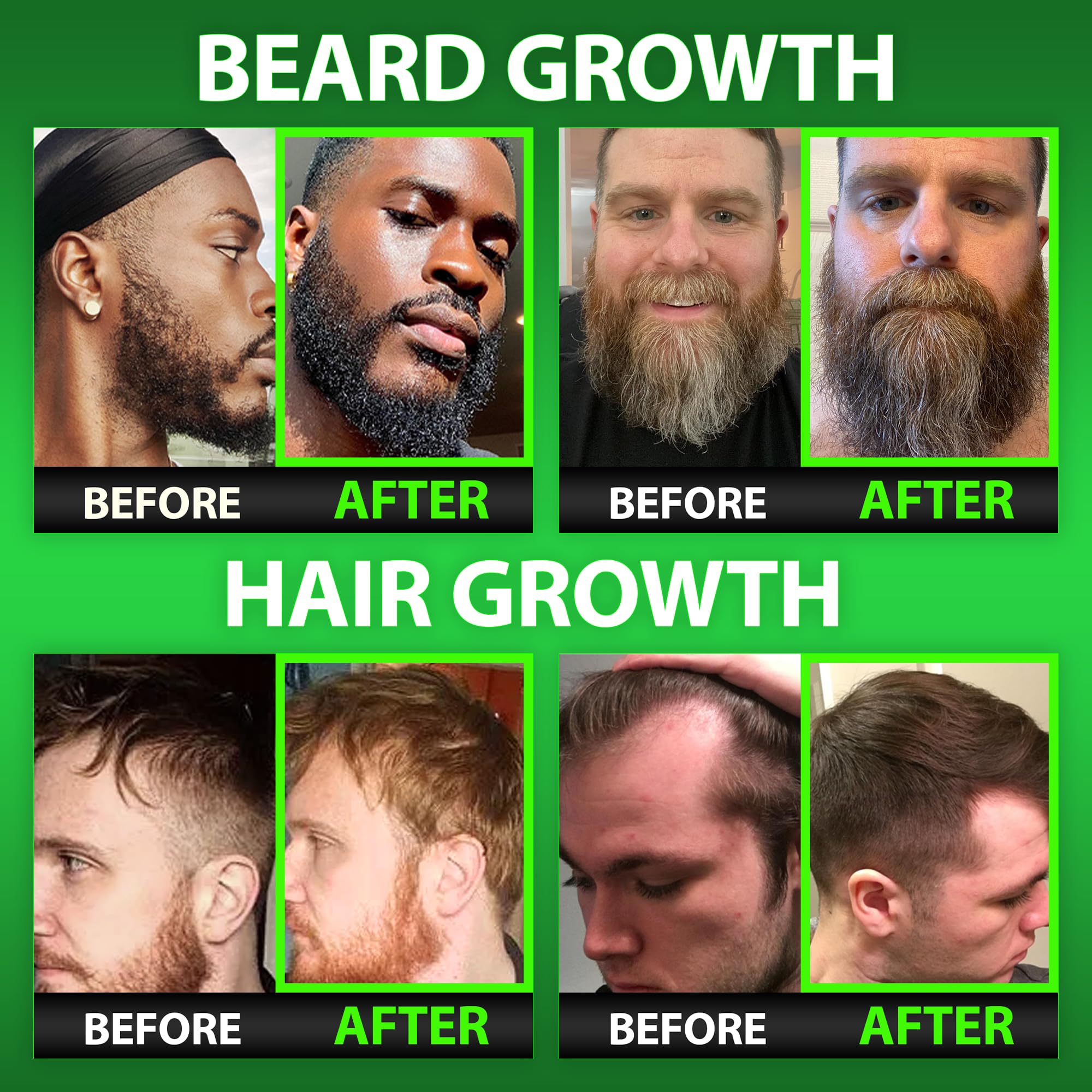 GROW Hair & Beard Growth Oil Serum