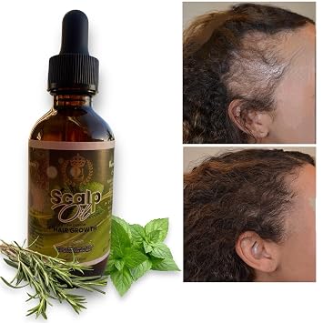 Scalp oil for massive hair growth