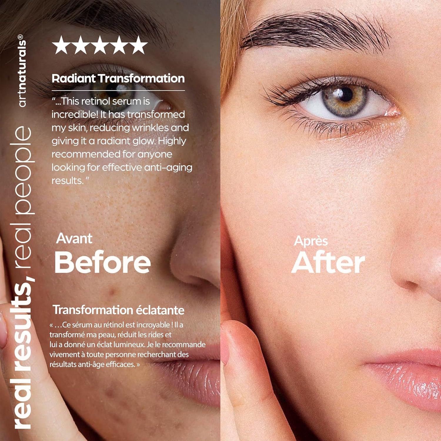 ArtNaturals Retinol Serum for Face - with Vitamin C, 2.5% Retinol Oil & Hyaluronic-Acid - Skin Clearing - Anti-Aging, Anti-Wrinkle Eye Serum - Skin Repair, Night Therapy (1 Fl Oz / 30ml) (ANGA-0127) - Image 8