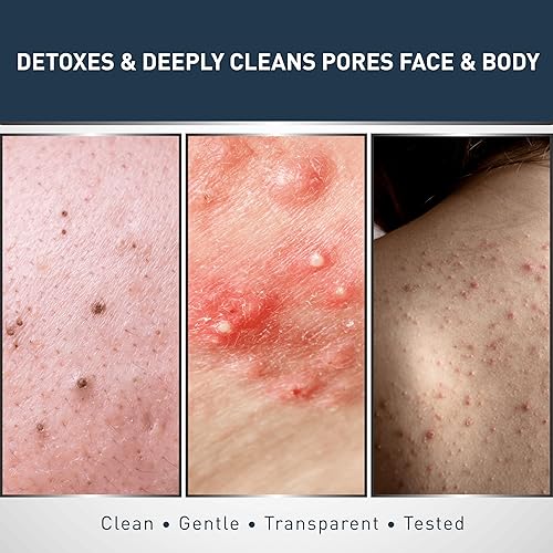 Miniatura 4 de Jericho Barra de jabón de barro del Mar Muerto, desintoxicación natural para rostro y cuerpo con minerales exfoliantes del Mar Muerto y hamamelis