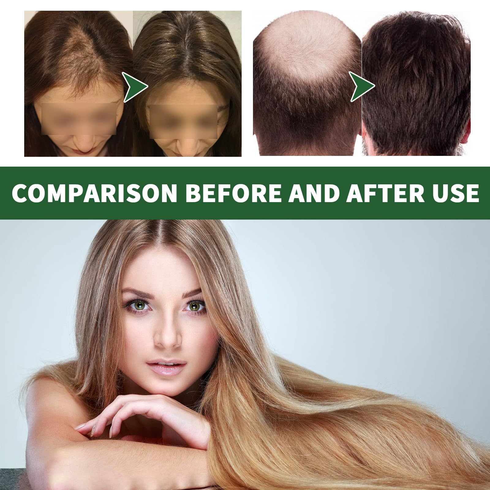 Cadu-Crex NEO MITO Shampoo INITIAL Hair Loss for Men 500ml