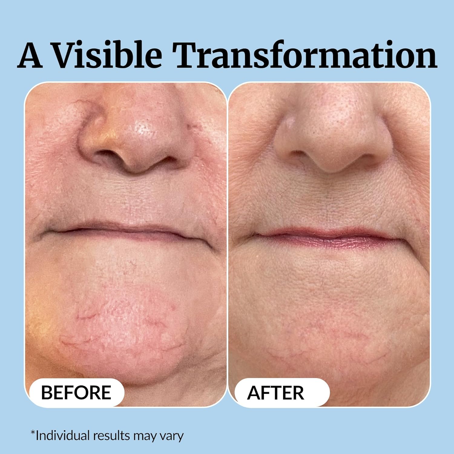 Vibriance Super C Serum for Mature Skin - All-in-One Vitamin Formula Hydrates, Firms, Lifts, Smooths, Targets Age Spots, Wrinkles, 1 fl oz - Image 5