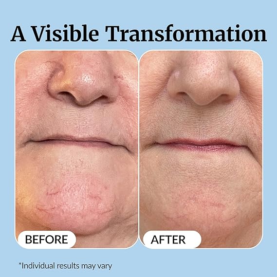 Vibriance Super C Serum for Mature Skin - All-in-One Vitamin Formula Hydrates, Firms, Lifts, Smooths, Targets Age Spots, Wrinkles, 1 fl oz