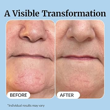 Vibriance Super C Serum for Mature Skin - All-in-One Vitamin Formula Hydrates, Firms, Lifts, Smooths, Targets Age Spots, Wrinkles, 1 fl oz