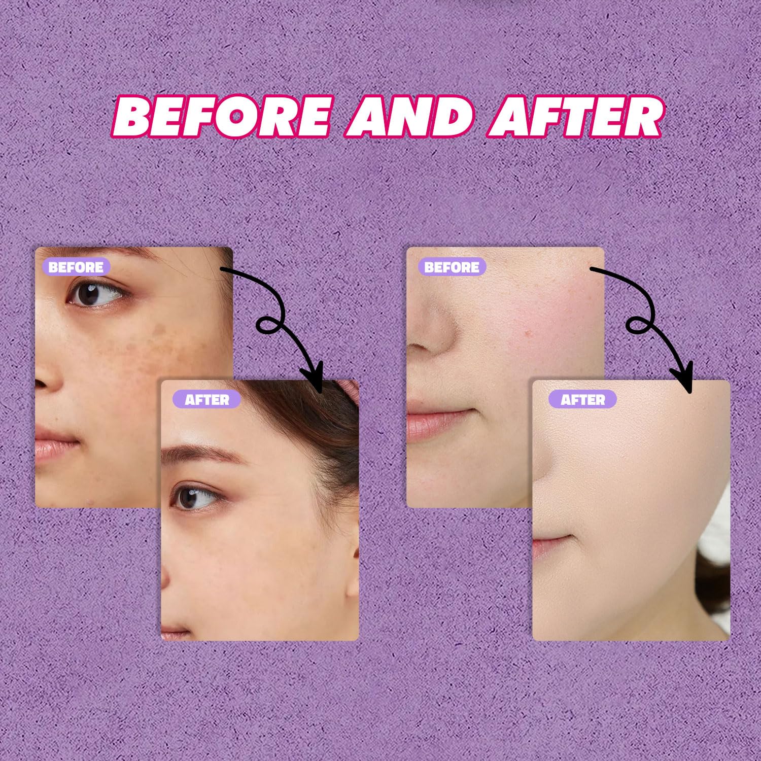 Dark Spot Remover for Face and Body - Dark Spot Corrector, Age Spot Sun Spot Freckles Dark Spot Remover, Melasma Treatment for Women and Men(1.7 FL OZ) - Image 2