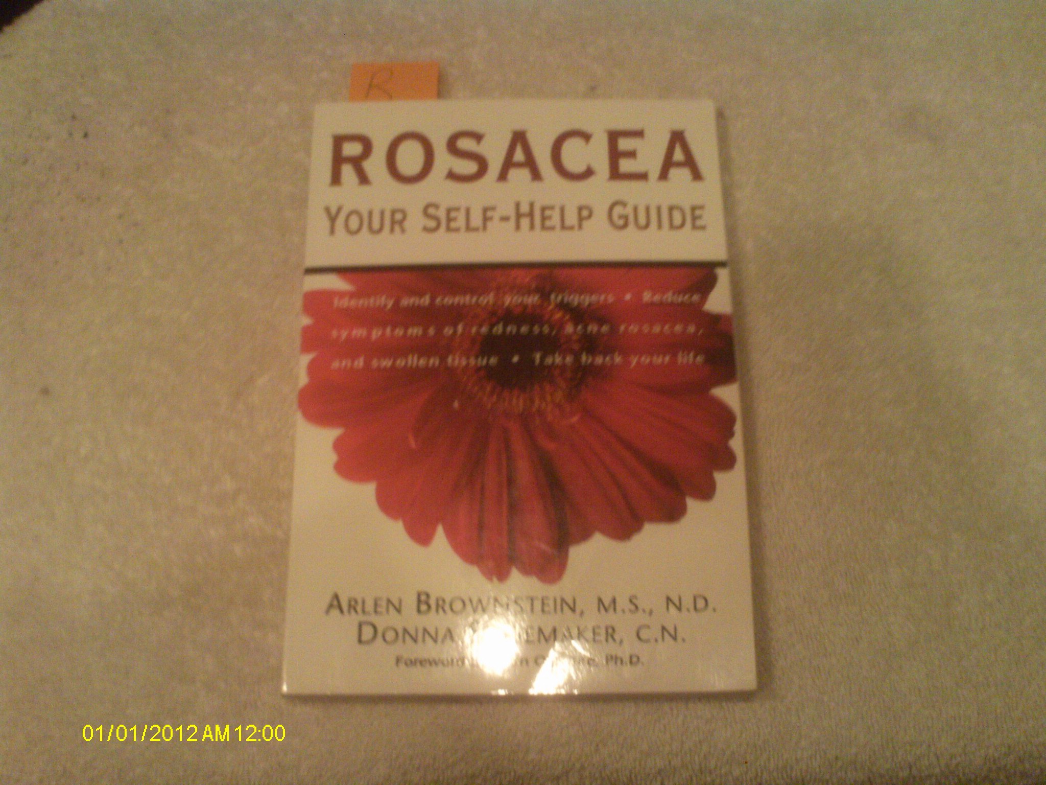 Rosacea Paperback – Big Book, 28 February 2001