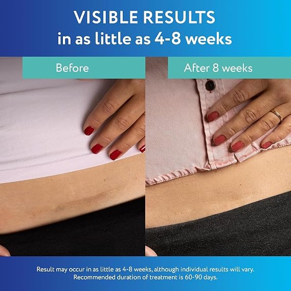 ScarAway Advanced Clear Silicone Scar Sheets, Medical Grade Silicone Strips (1.5 x 3) Scar Treatment and Prevention for Surgical, Burn, Body, Hypertrophic & Keloid Scar Treatment, 6 Clear Sheets