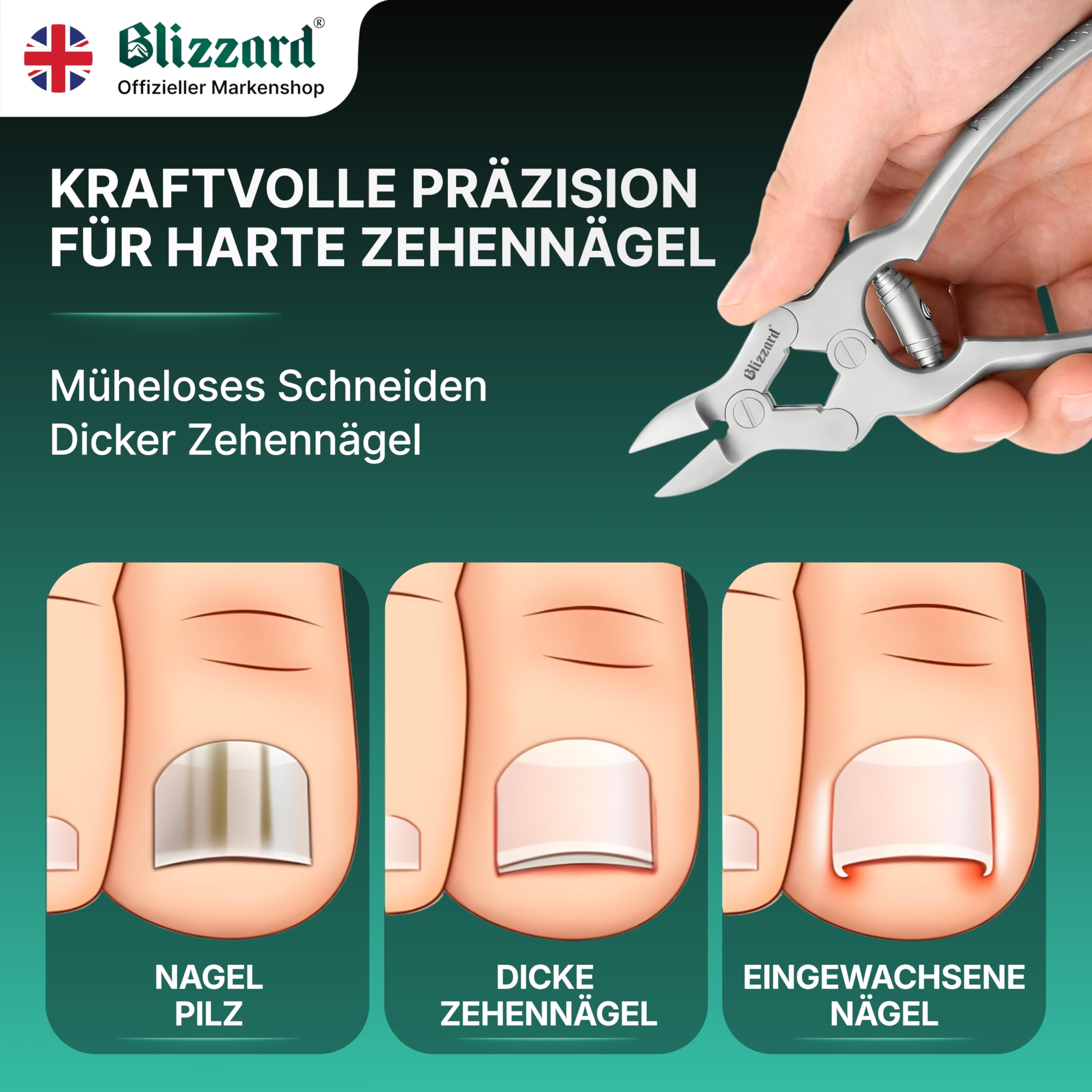 Blizzard Nagelzange für Fußnägel – Extra starke Fußnagelzange für dicke, harte & eingewachsene Zehennägel – Profi Pediküre Fußpflege Werkzeug aus Edelstahl inkl. Nagelfeile – 15 cm Pufferfeder