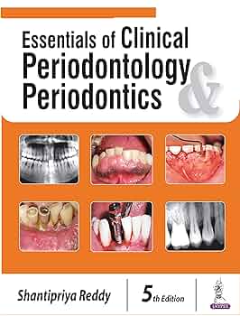 健康・医学 Textbook of Clinical Periodontology Carranza's Clinical Periodontology: 9781416024002: Medicine