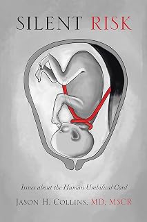 Silent Risk: Issues About the Human Umbilical Cord (Second Edition)