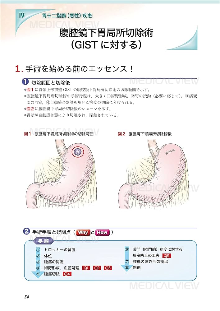 消化器疾患に対する腹腔鏡手術 術野形成の基礎固め メジカルビュー社｜消化器外科｜消化器疾患に対する腹腔鏡手術