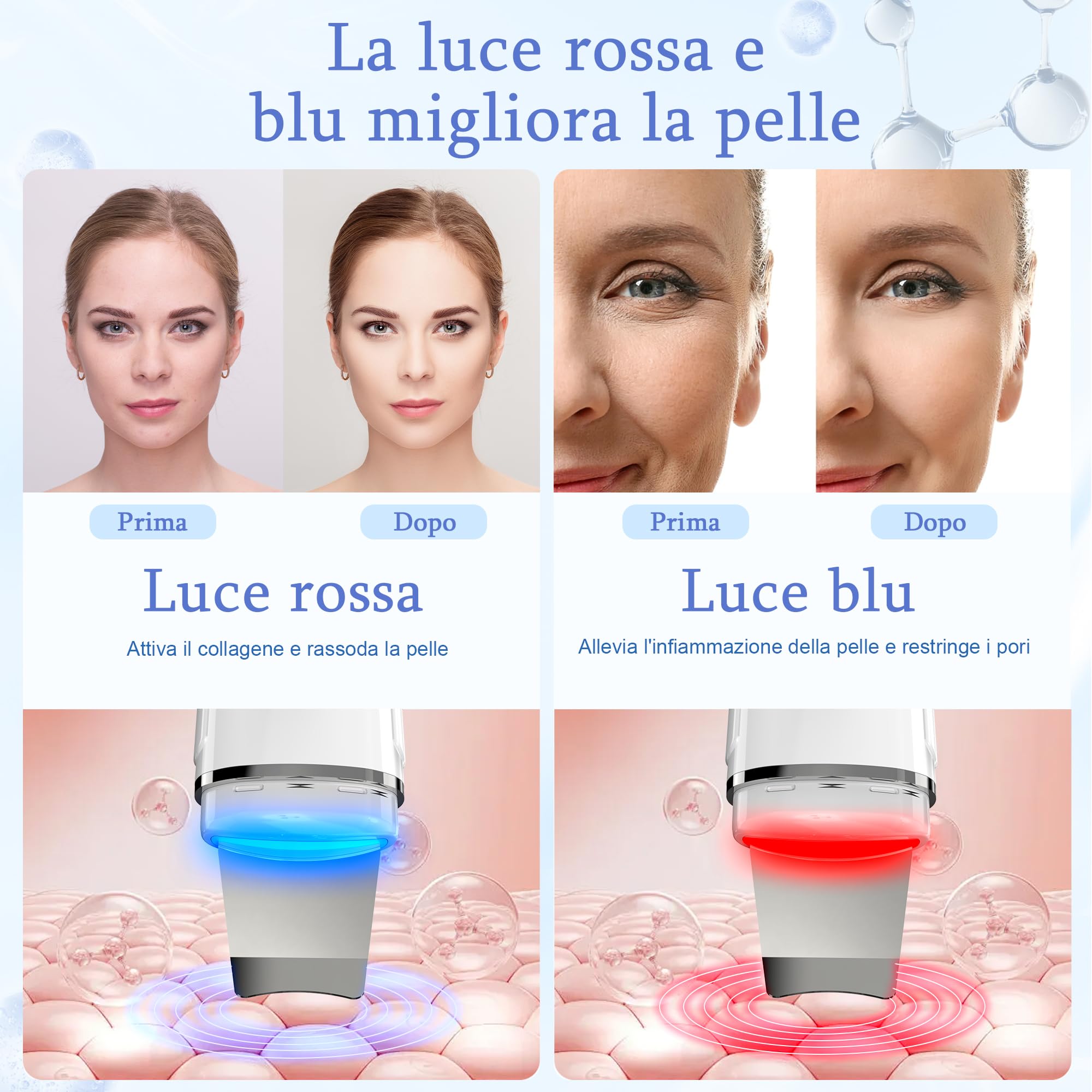 Pulizia Viso Ultrasuoni, Skin Scrubber con 4 Modalità e Luce Rossa e Blu, Spatola Professionale Punti Neri Rimozione Pulizia Profonda la Viso Peeling e Cura