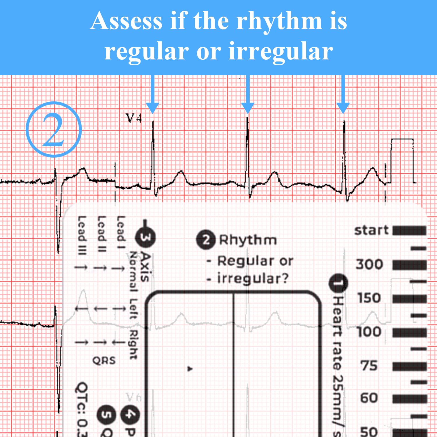 ECG Ruler 2-Pack ECG 7 Step Ruler - Portable EKG Interpretation Tool ...