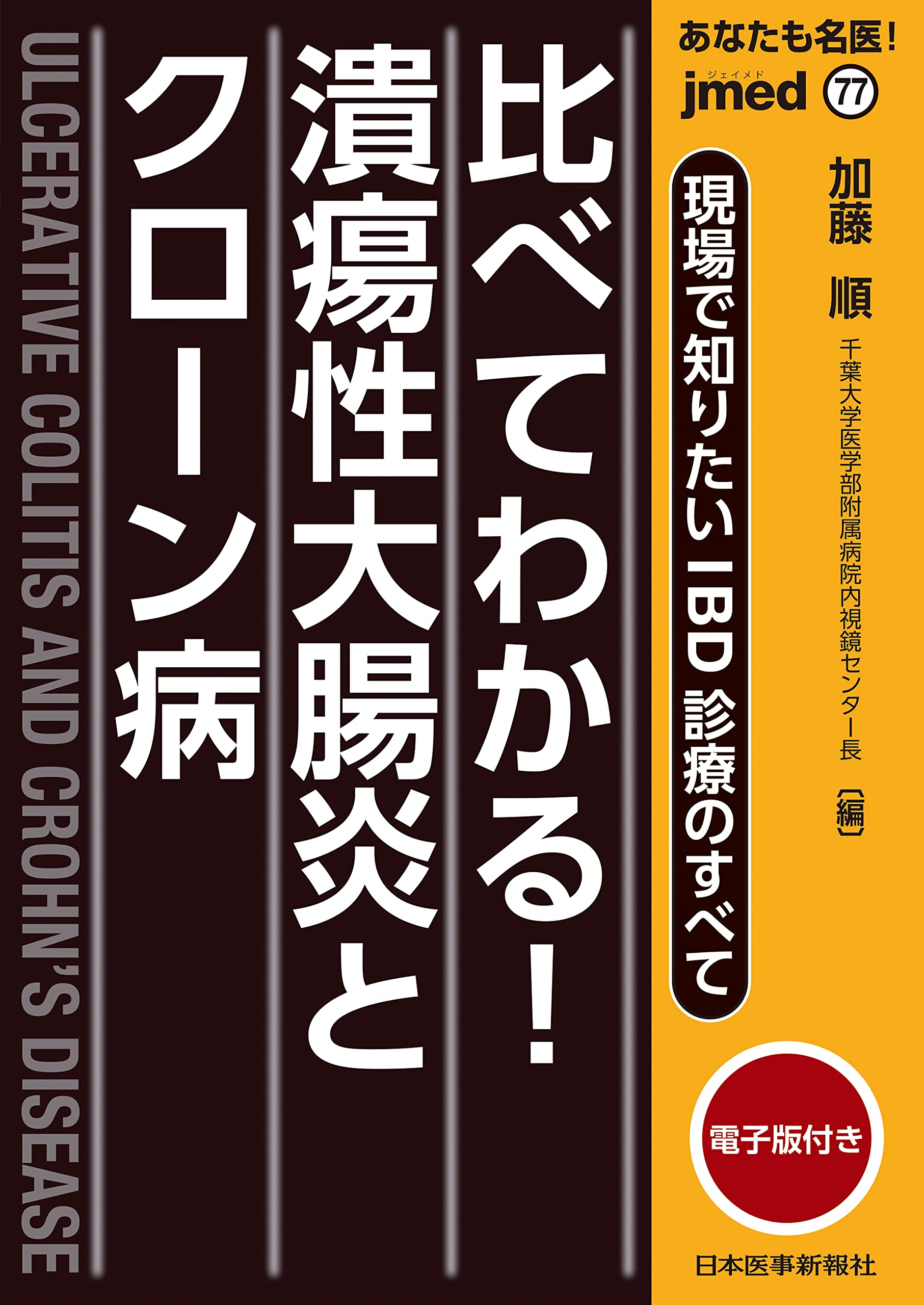 あなたも名医! 現場で知りたいIBD診療のすべて 比べてわかる! 潰瘍性