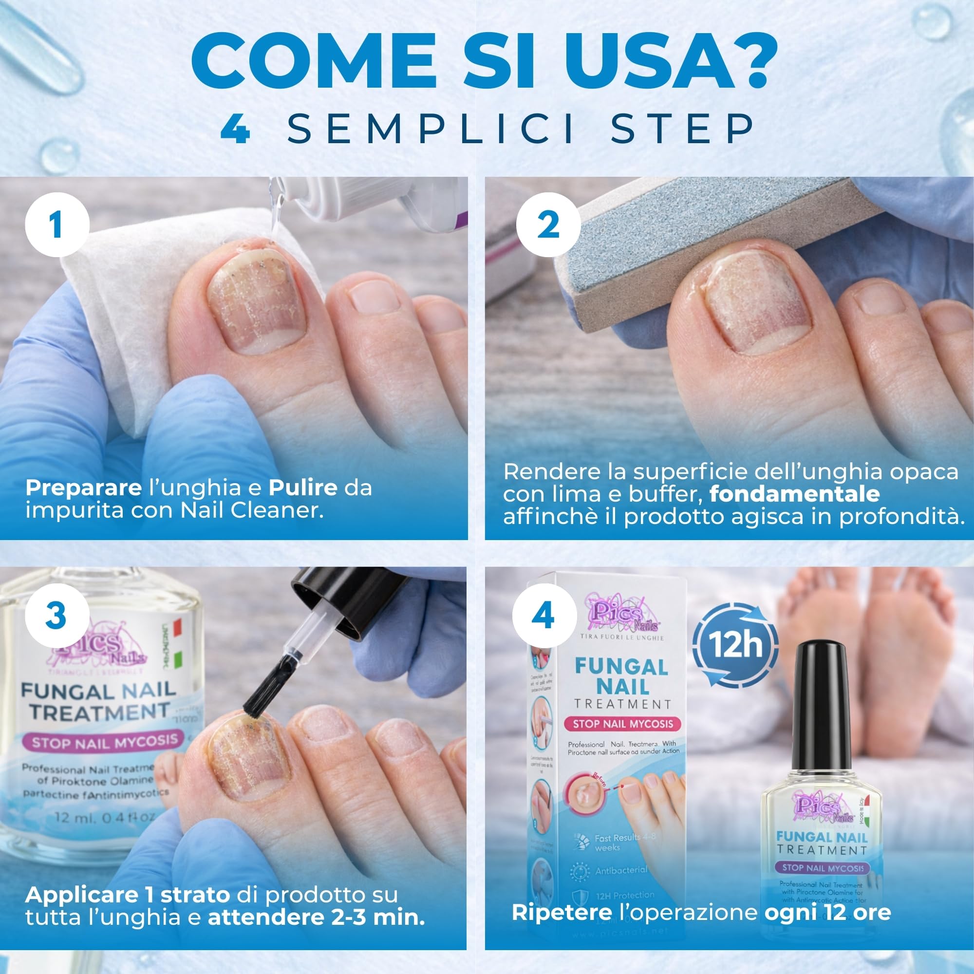Antimicotico Micosi Unghie Piedi e Mani 12 ml - Trattamento della Micosi del Piede e della Mano, Previene e la Micosi/Funghi dalle Unghie di Piedi e Mani e Ripristina il Naturale Aspetto dell'Unghia.