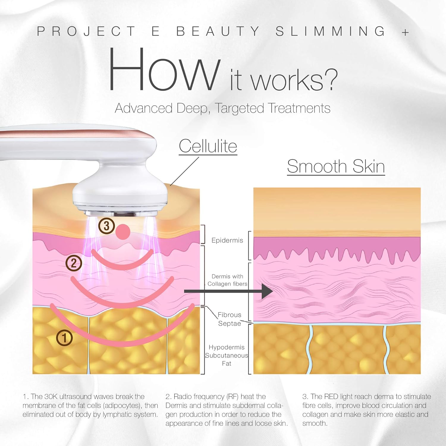 Detailed diagram explaining how the device works at a cellular level, showing ultrasonic waves breaking fat cells, RF heating the dermis to stimulate collagen, and red light improving blood circulation.