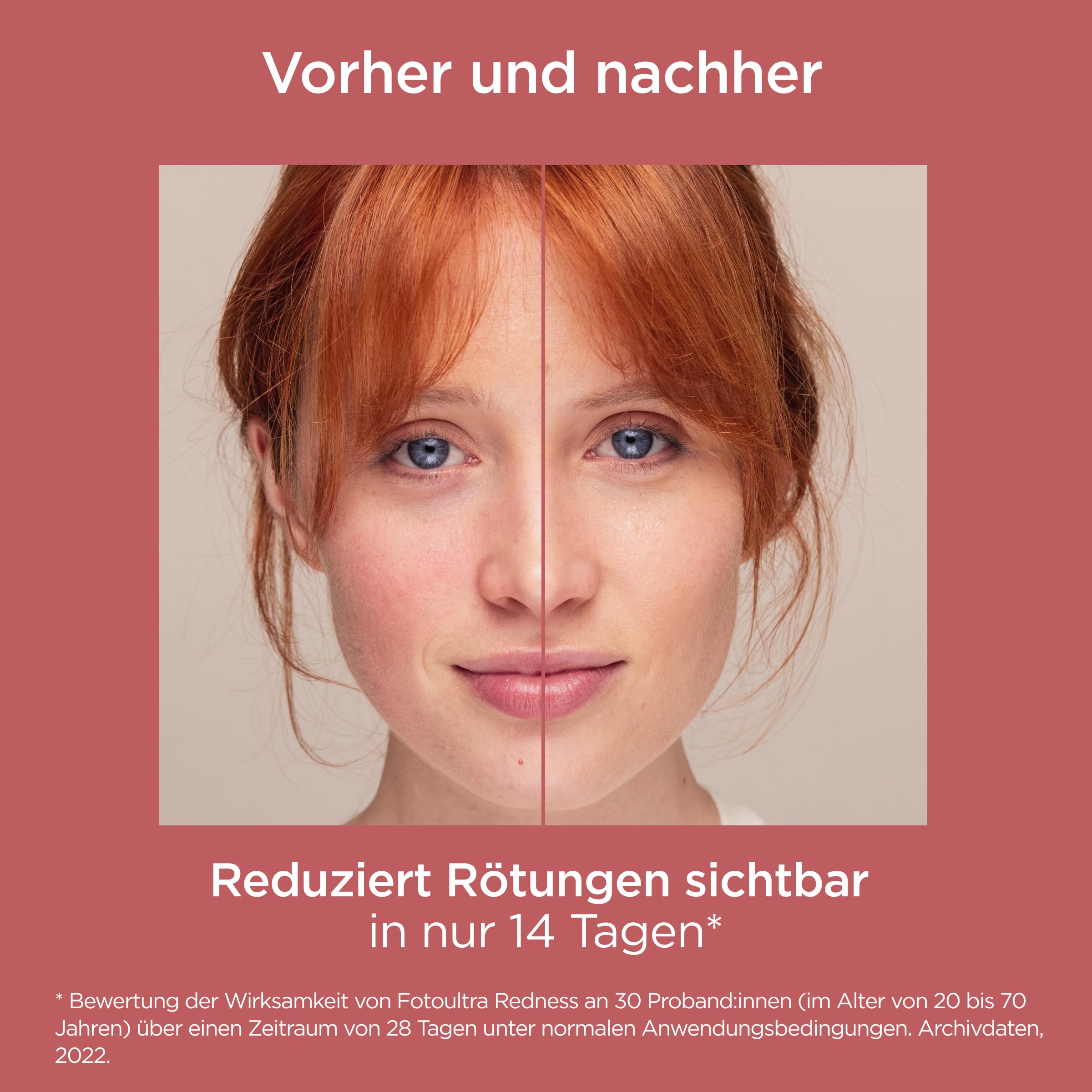ISDIN Foto Ultra Redness LSF 50 - Sonnenschutz bei Rosazea & Couperose - Korrigiert & Verhindert Rötungen - Beruhigt empfindliche Haut, Leichte Textur, 50ml