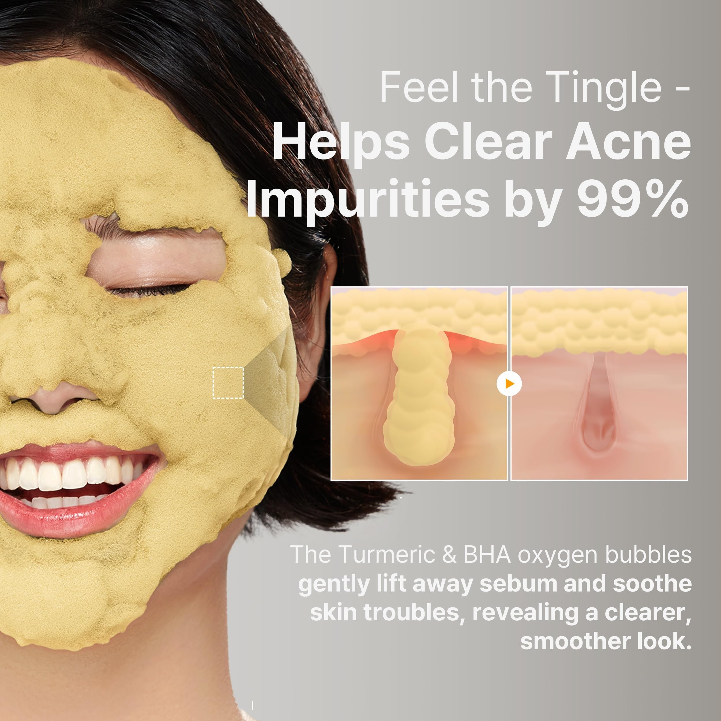Mascarilla limpiadora de burbujas con cúrcuma (90 g) – Limpieza profunda con AHA y ácido salicílico; calma el enrojecimiento, ilumina el rostro y equilibra la grasa (mascarilla de enjuague)