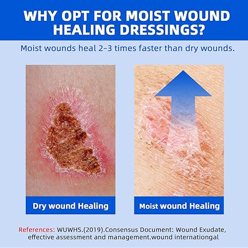 Miniatura 6 de Apósito de espuma de silicona Lite de 3 x 3 pulgadas, borde suave, vendajes impermeables grandes para quemaduras, abrasiones, heridas quirúrgicas,