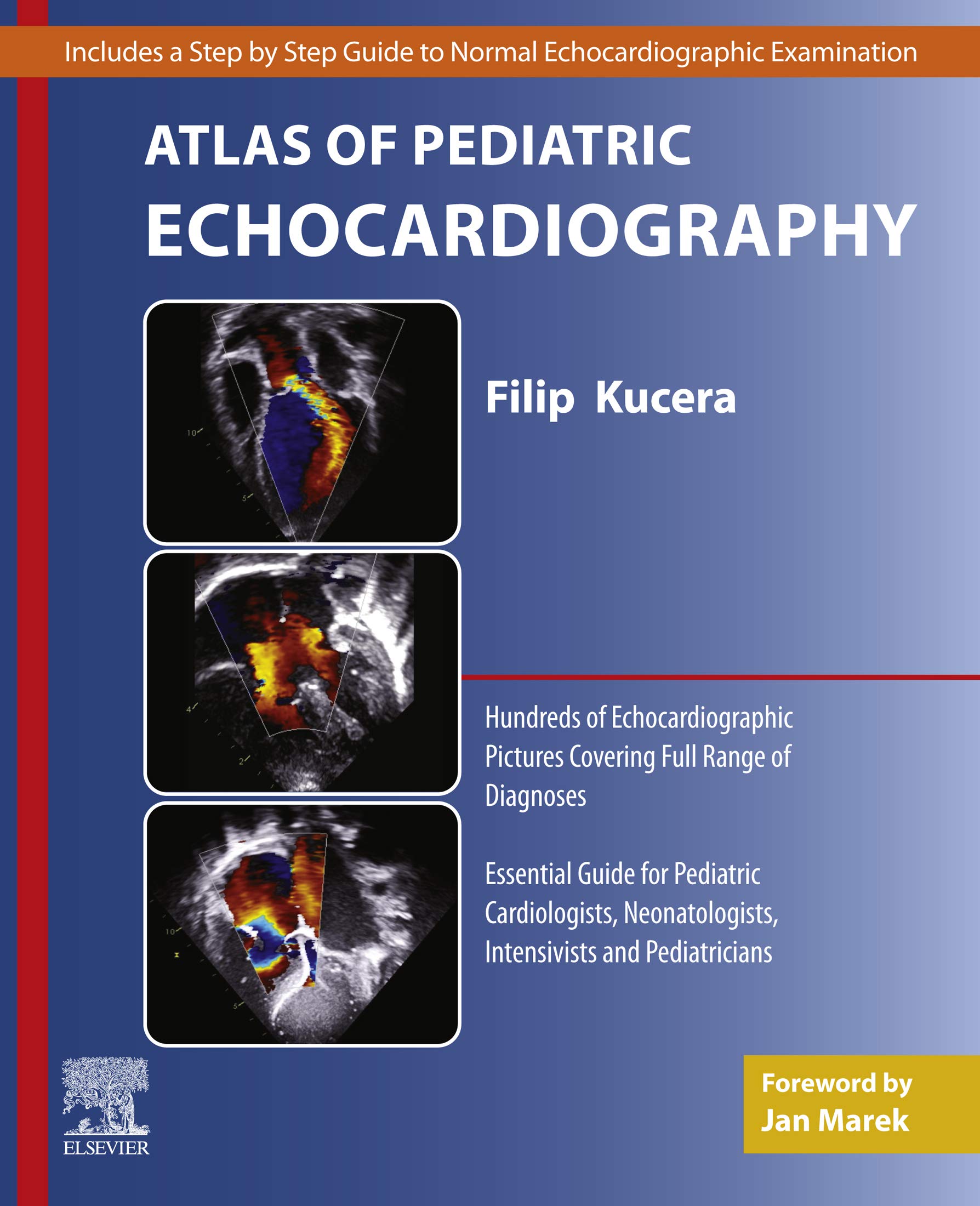 Atlas of Pediatric Echocardiography (English Edition)