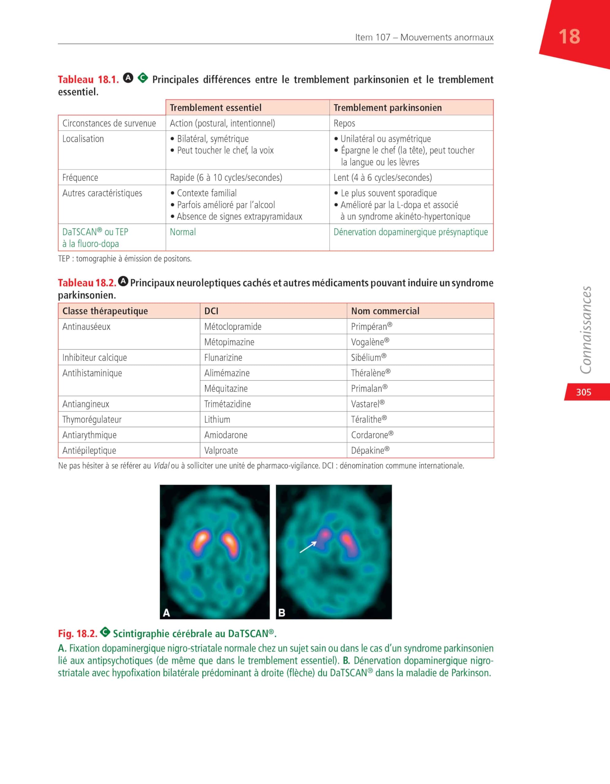 Neurologie: Réussir ses EDN