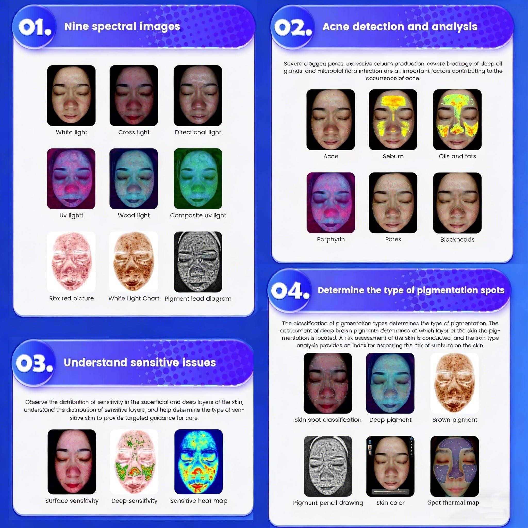 Strumento per L'analisi del Viso, Analizzatore Cutaneo Ia Professionale, 36 Megapixel, Dispositivo Diagnostico per L'analisi di Pelle E Cuoio Capelluto, per Acne,Pigmentazione 15.6in