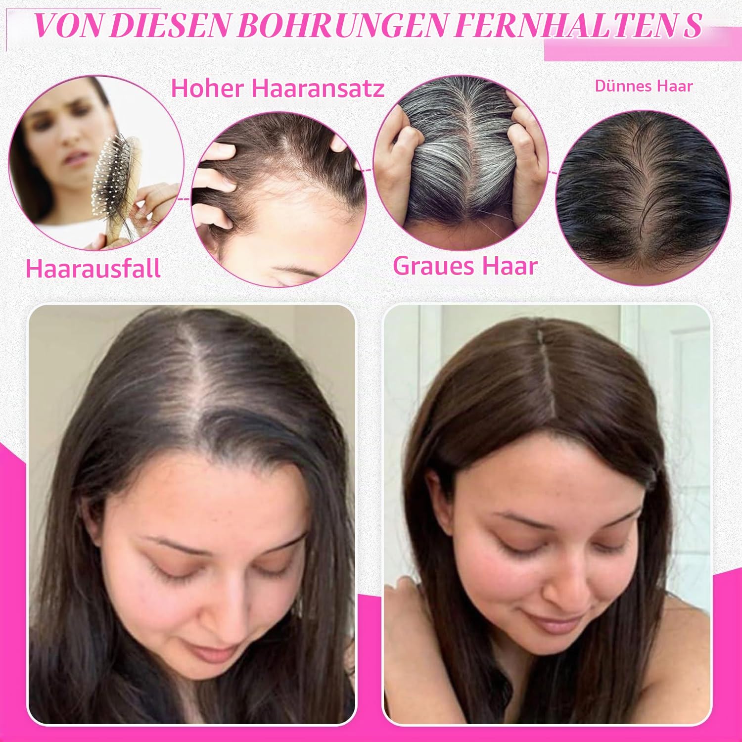 Haarteile für Frauen aus echtem menschlichem Haar Topper für schüttere Kronen unsichtbare Aufwertung handgeknotete Schweizer Spitzenbasis Haarteile ohne Pony realistische Haaransatzlinie Natürliche