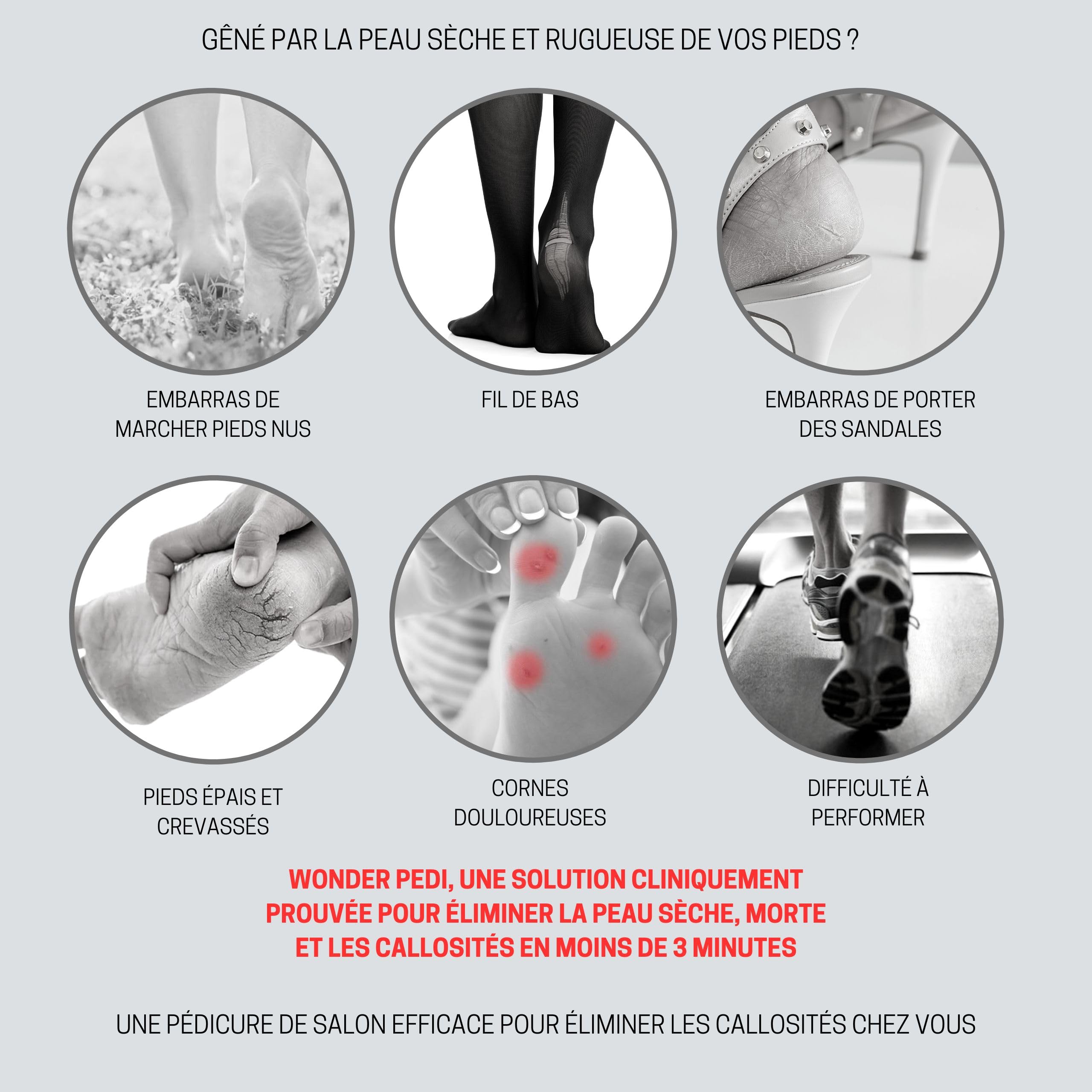 Détachant les callosités - Fixation rapide en trois minutes - Râpe pour les pieds - Exfoliant instantané pour les pieds - Spray exfoliant instantané - Lime à récurer les callosités - Traitement de