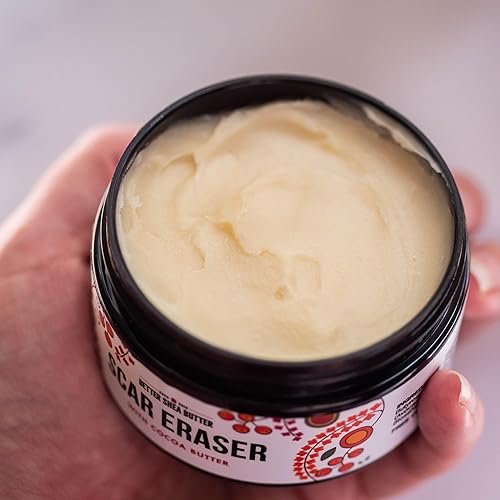 Miniatura 2 de Better Shea Butter - Mantequilla corporal para eliminar o reducir la apariencia de cicatrices, estrías, marcas de quemadura, cicatrices de acné,
