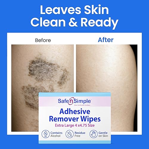 Miniatura 35 de Safe n' Simple Removedor de adhesivo para piel – 75 toallitas removedoras de adhesivo médico sin picaduras envueltas individualmente de 5 x 7