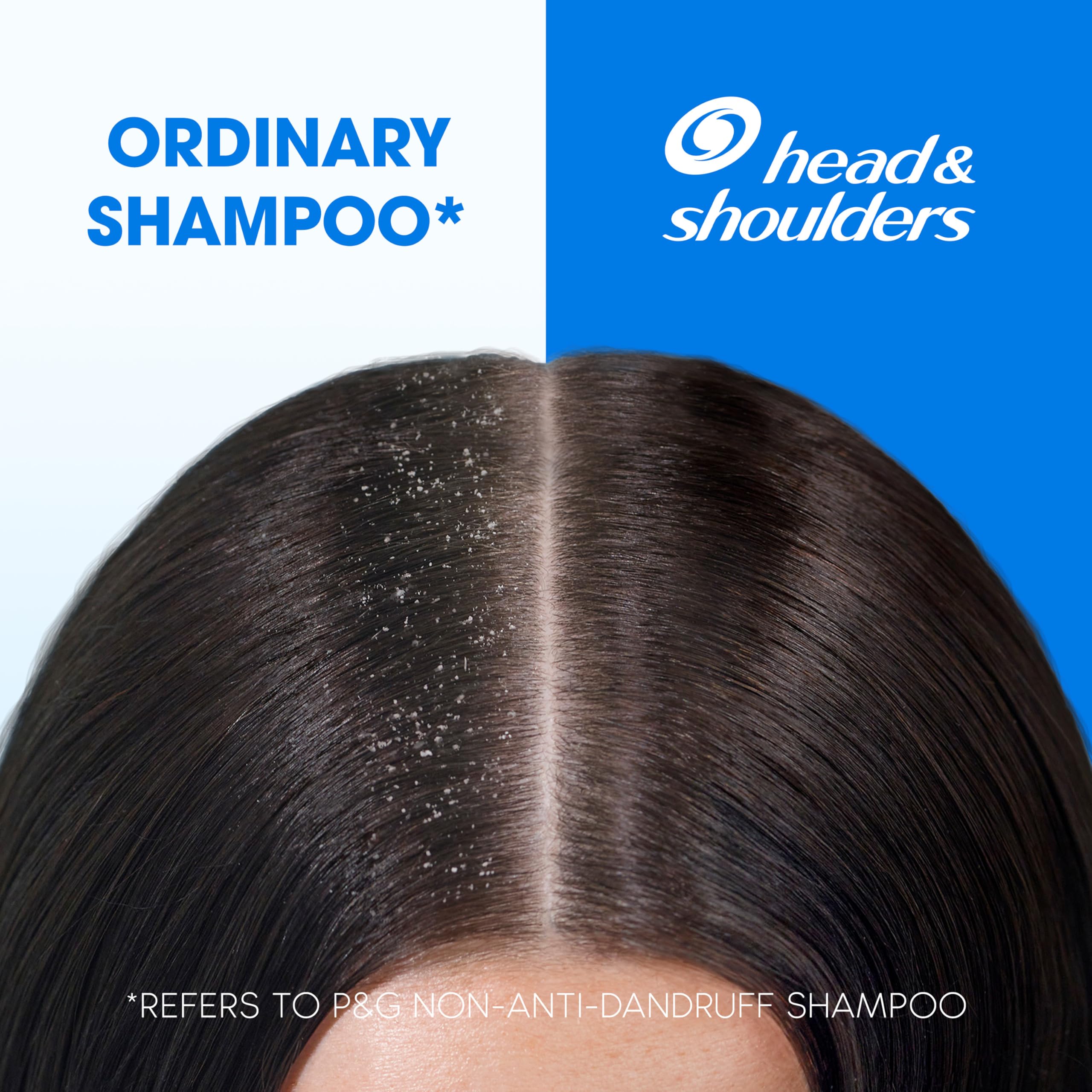 head & shoulders ヘッドアンドショルダー まとめ売り Amazon | head&shoulders anti-dandruff shampoo cool menthol 350ml