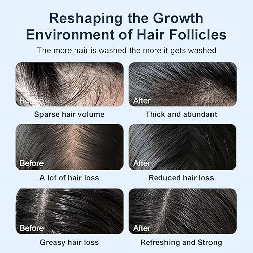 Miniatura 6 de Tgideas Champú orgánico para el crecimiento del cabello con biotina y romero  Champú espesante con aminoácidos para la pérdida del cabello, control