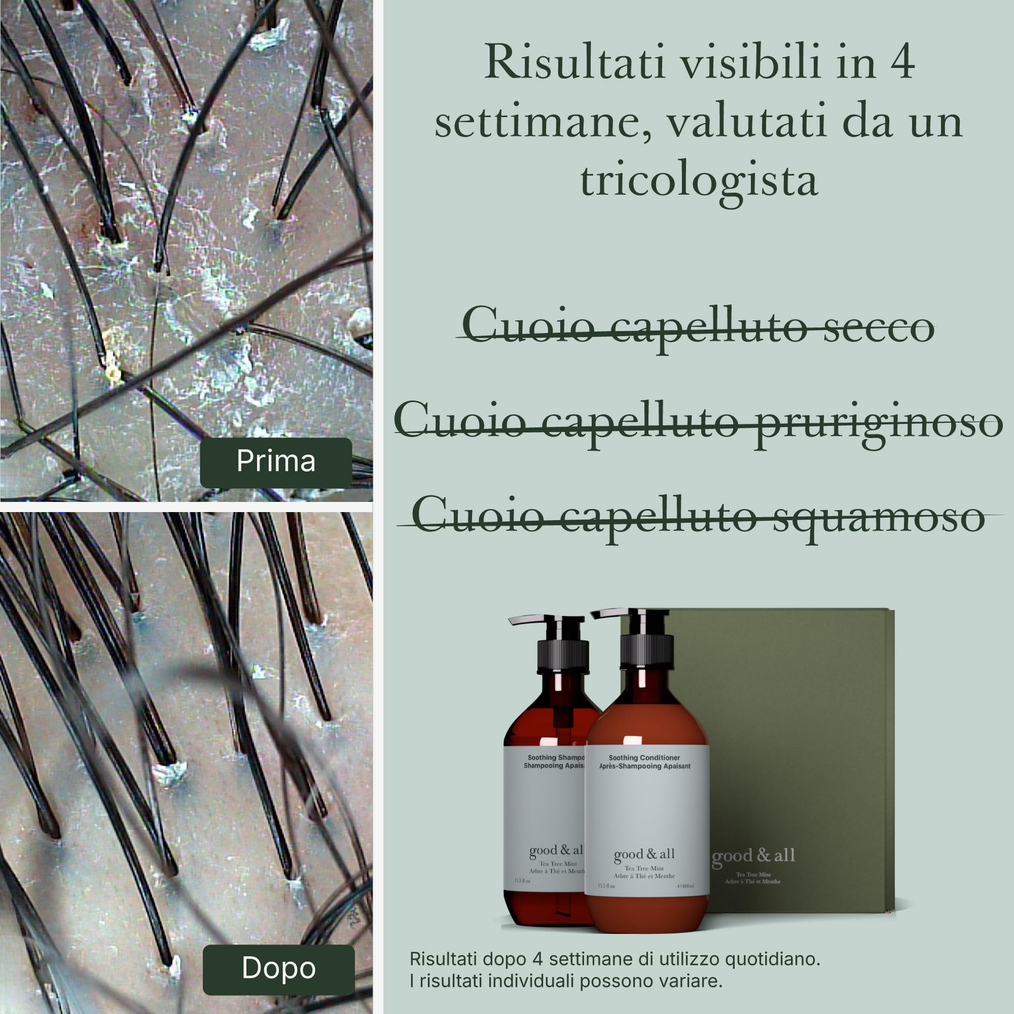 Good&All Set Shampoo e Balsamo Capelli Anti Prurito per Cuoio Capelluto Secco e Sensible con Tea Tree Menta - senza Solfati, Siliconi, Parabeni, Profumo - 400ml