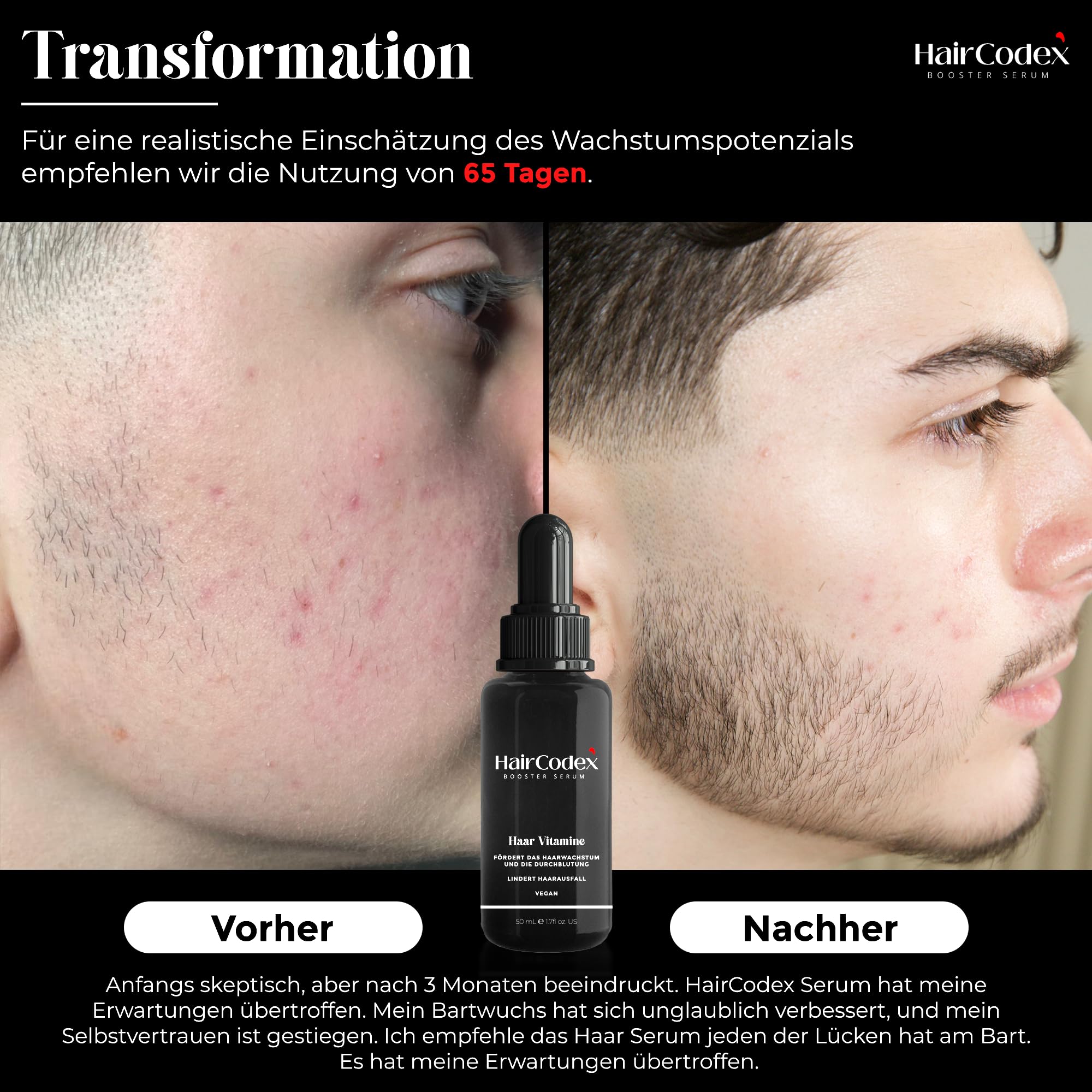 Booster Serum 3x 50ML Haarwuchsmittel mit Biotin und Keratin, 1x HC Stimulator Dermaroller für Haare oder Bart, Erblich Bedingten Haarausfall, 150 ml