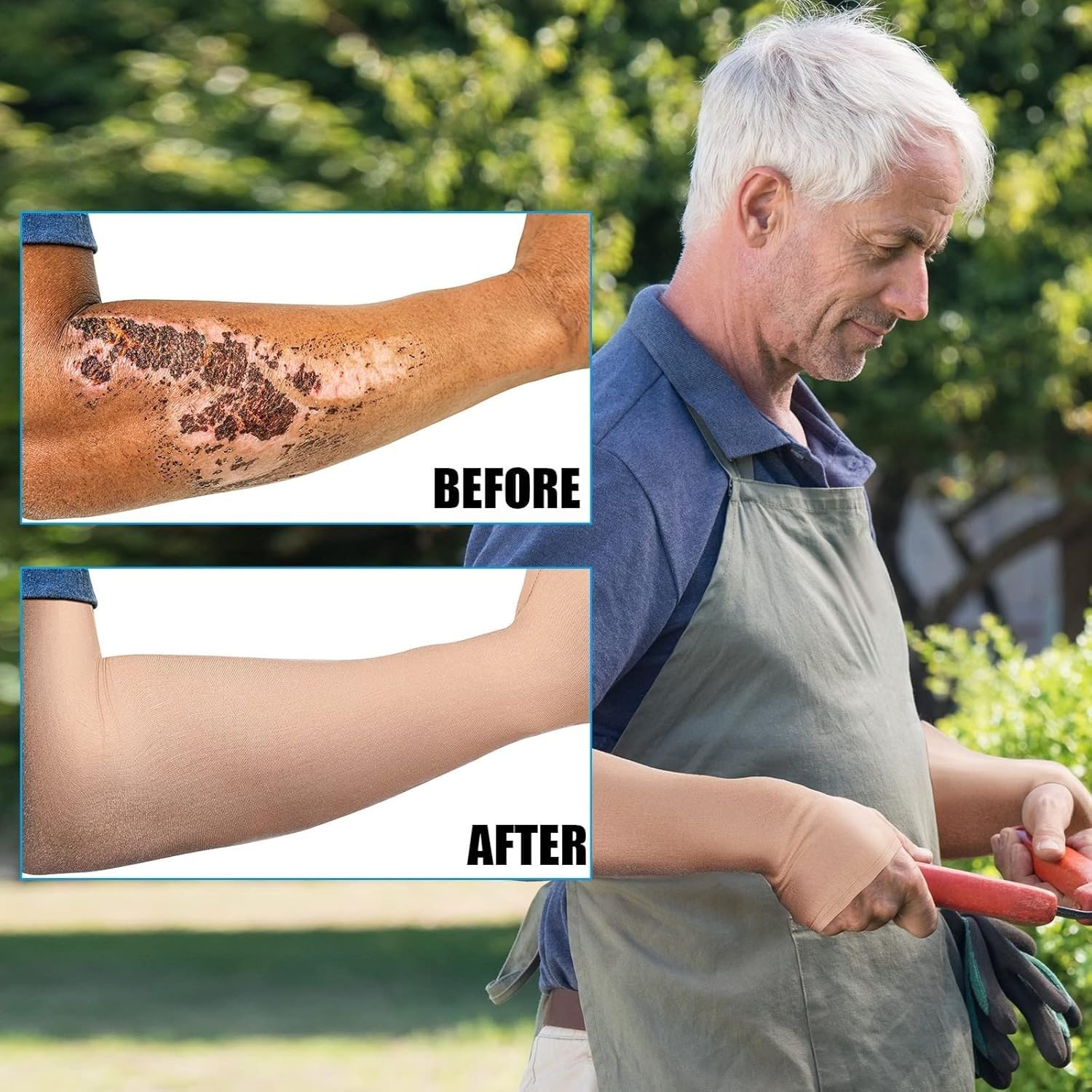 Mangas protectoras para la piel de los ancianos, protectores de brazo para compresión delgada y moretones, lavables, para hombres y mujeres, manga protectora de brazo para piel fina, mujeres