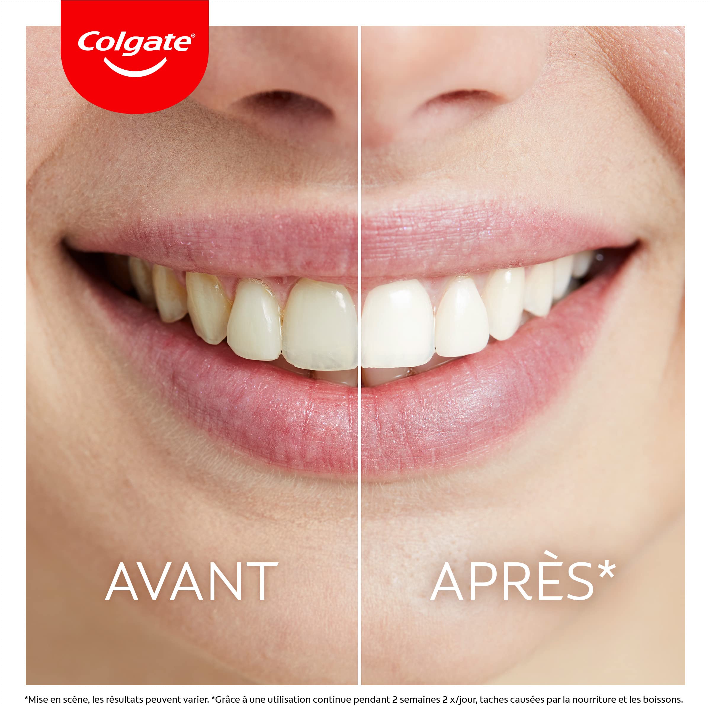 COLGATE - Kit Blanchiment Dentaire Max White à Domicile, Respecte l'Émail, Élimine Jusqu'à 20 Ans de Taches, Sérum blancheur et Lumière LED Alimentée par Smartphone