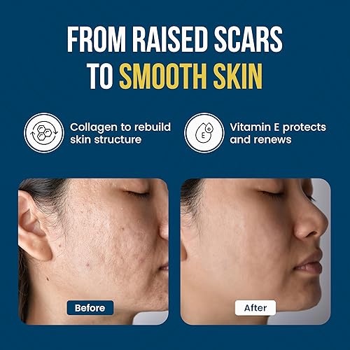 Miniatura 4 de Wound Care Plus Gomitas de colágeno  con péptidos de colágeno, biotina, zinc, vitaminas C y E  Apoya la salud de la piel, el cabello y las uñas  a