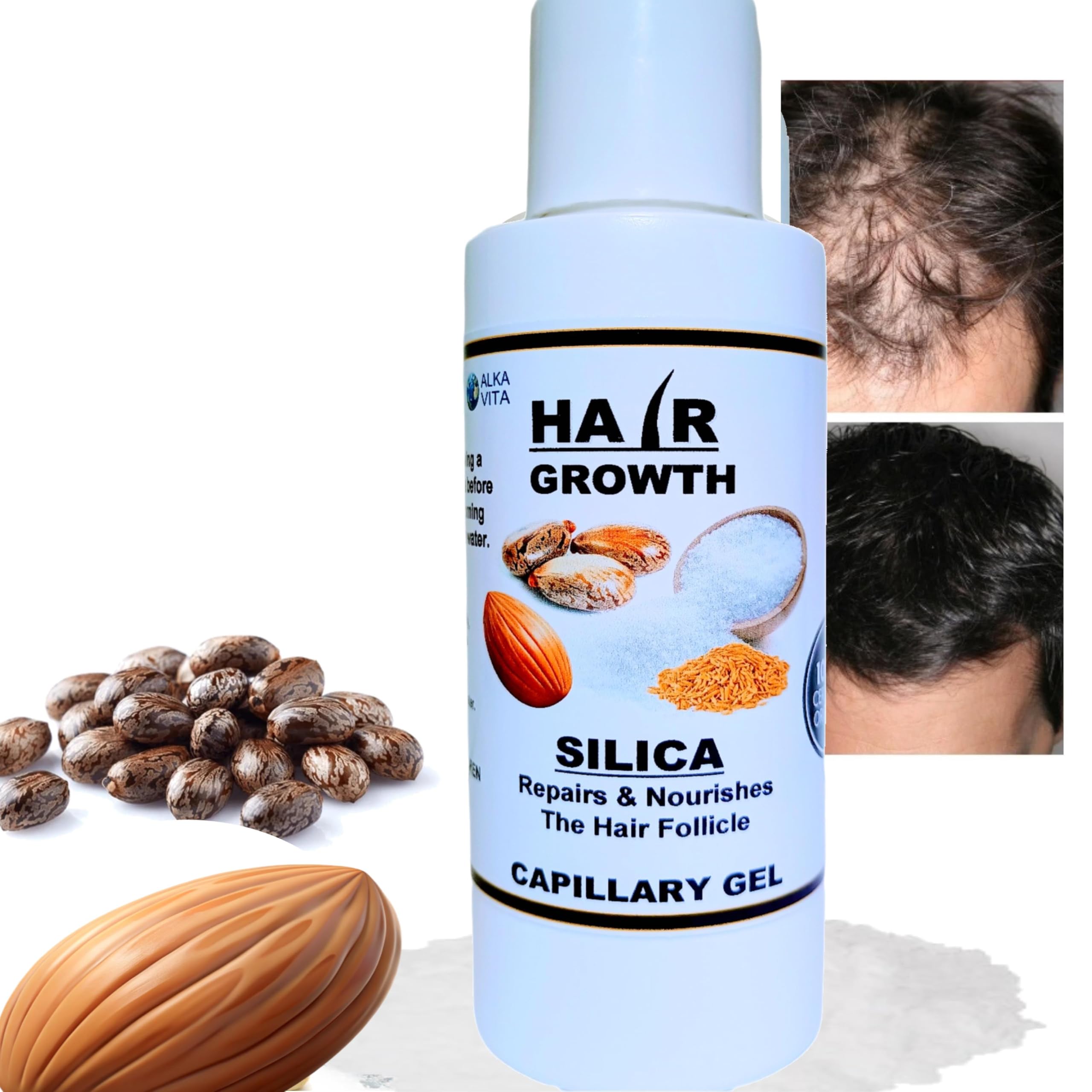 Amazon.com : Hair Loss Capillary Gel Silica Hair Thickener Sweet
