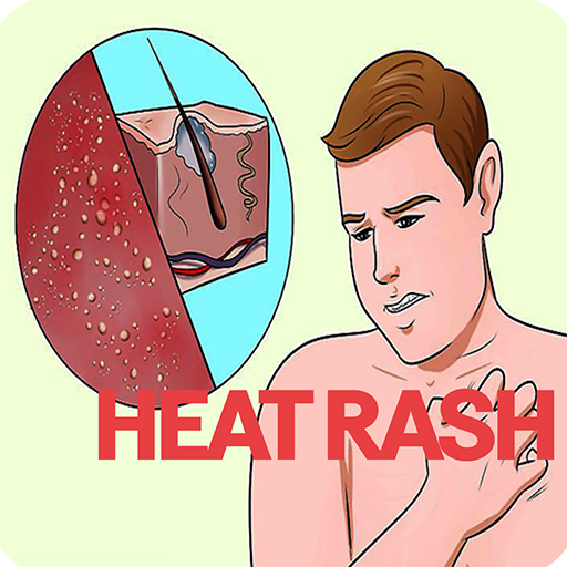 List of Ten Best For Heat Rash Top Picks 2023 Reviews