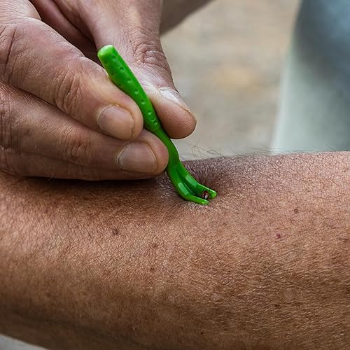 Miniatura 7 de TickCheck Paquete de 3 herramientas para eliminar garrapatas + tarjeta de identificación de garrapatas para humanos, perros y gatos (3)