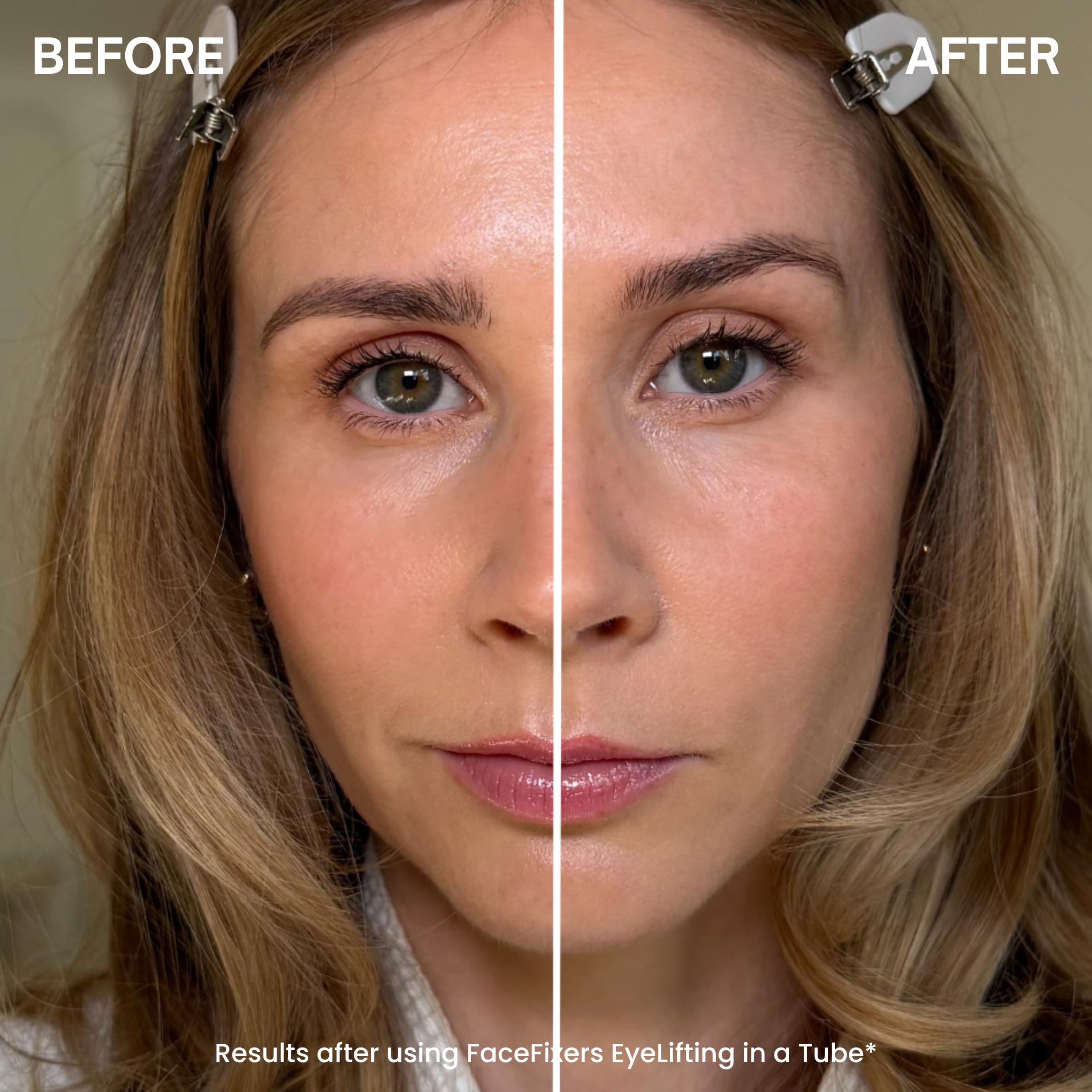 Transformulas Facefixers Duo Instant Lip Plumper & Eye Lift Serum LipVolume Vitamina E & Péptidos para labios más llenos, lifting ocular, anti-envejecimiento no invasivo, hidratante y reafirmante.