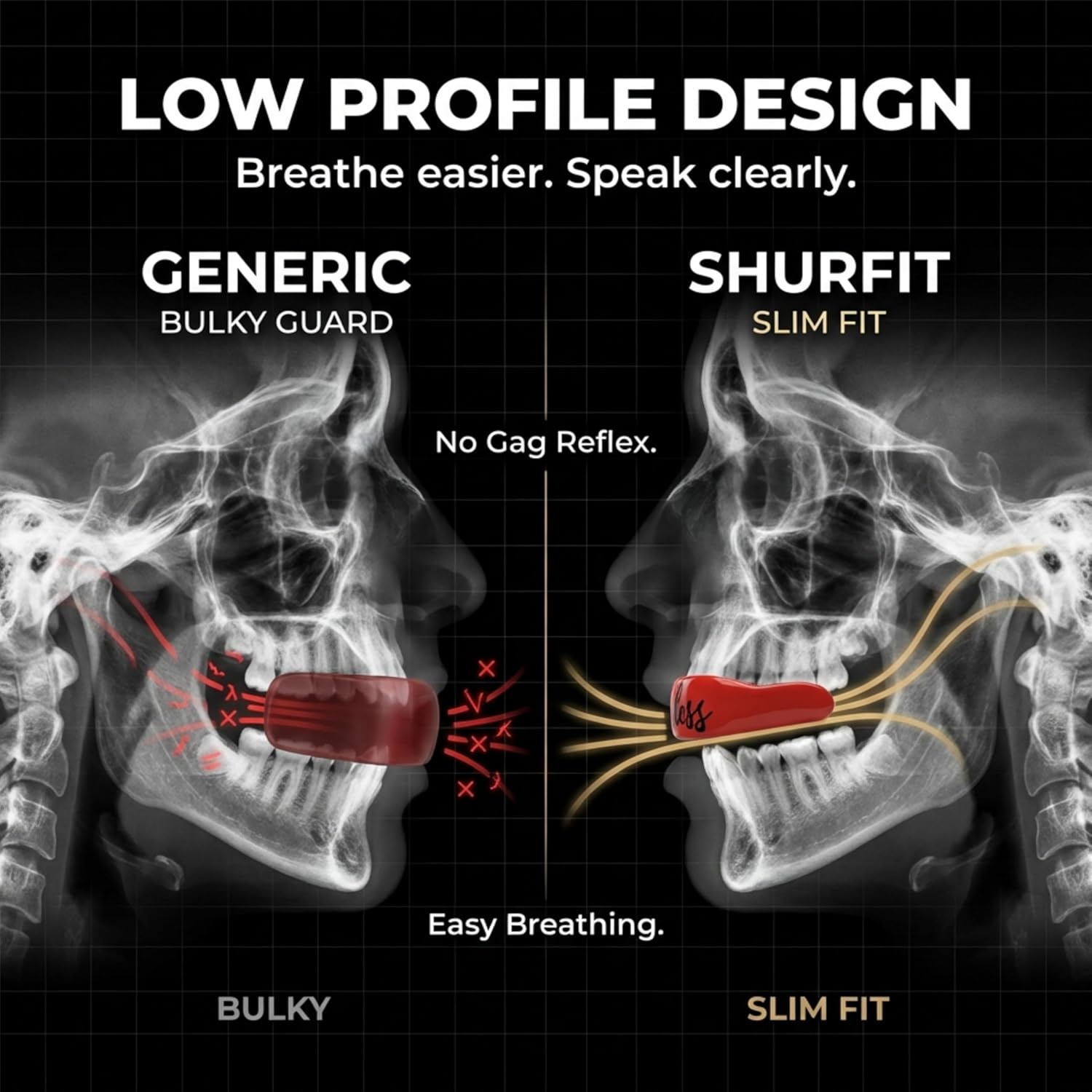 Shurfit Premium Mouth Guard for Sports - Boxing MMA Wrestling Football Mouthguard for Adults Youth Kids | Boil and Bite Moldable Mouthpiece for Braces Basketball Lacrosse Hockey (Fearless)