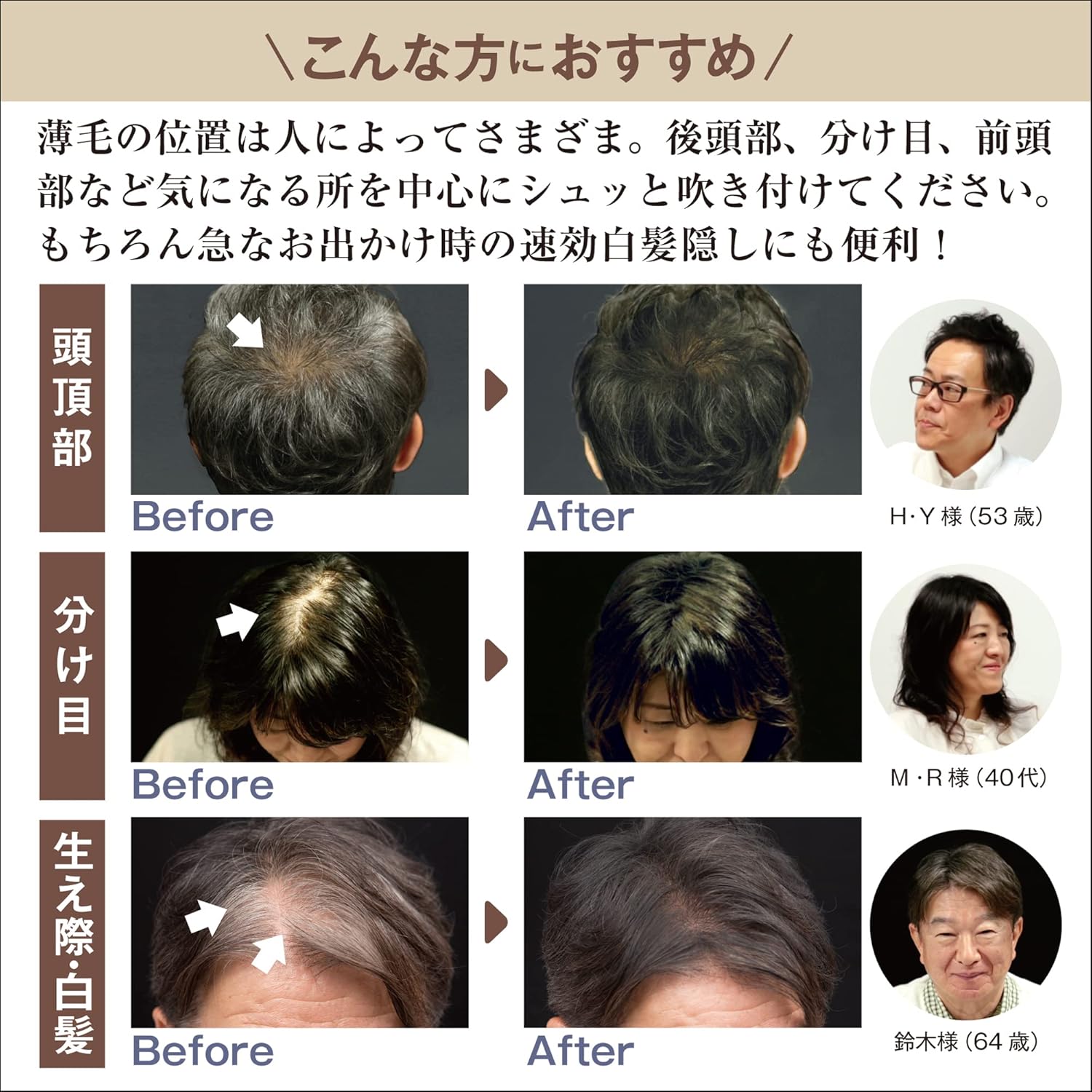 Amazon Co Jp Mag Aladdin Hair Growth Spray 7 1 Oz 0 G Black Time Saving Sweat Resistant Natural Finish Moisturizing Scalp Care Hair Care Beauty