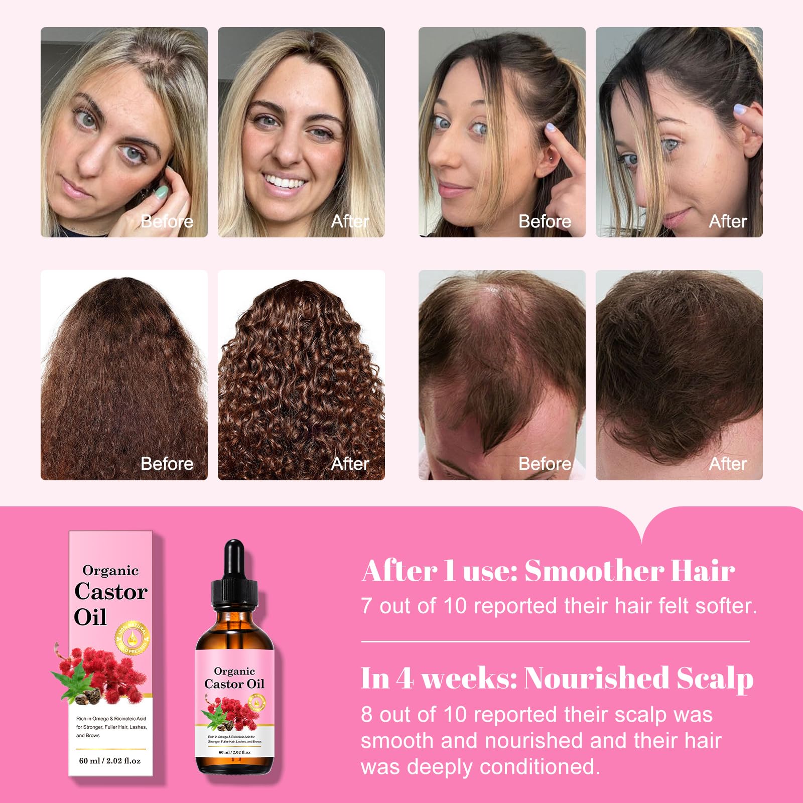 Labo Crescina Transdermic MITO Shampoo Re- Hair Growth 1700 for Women 150ml