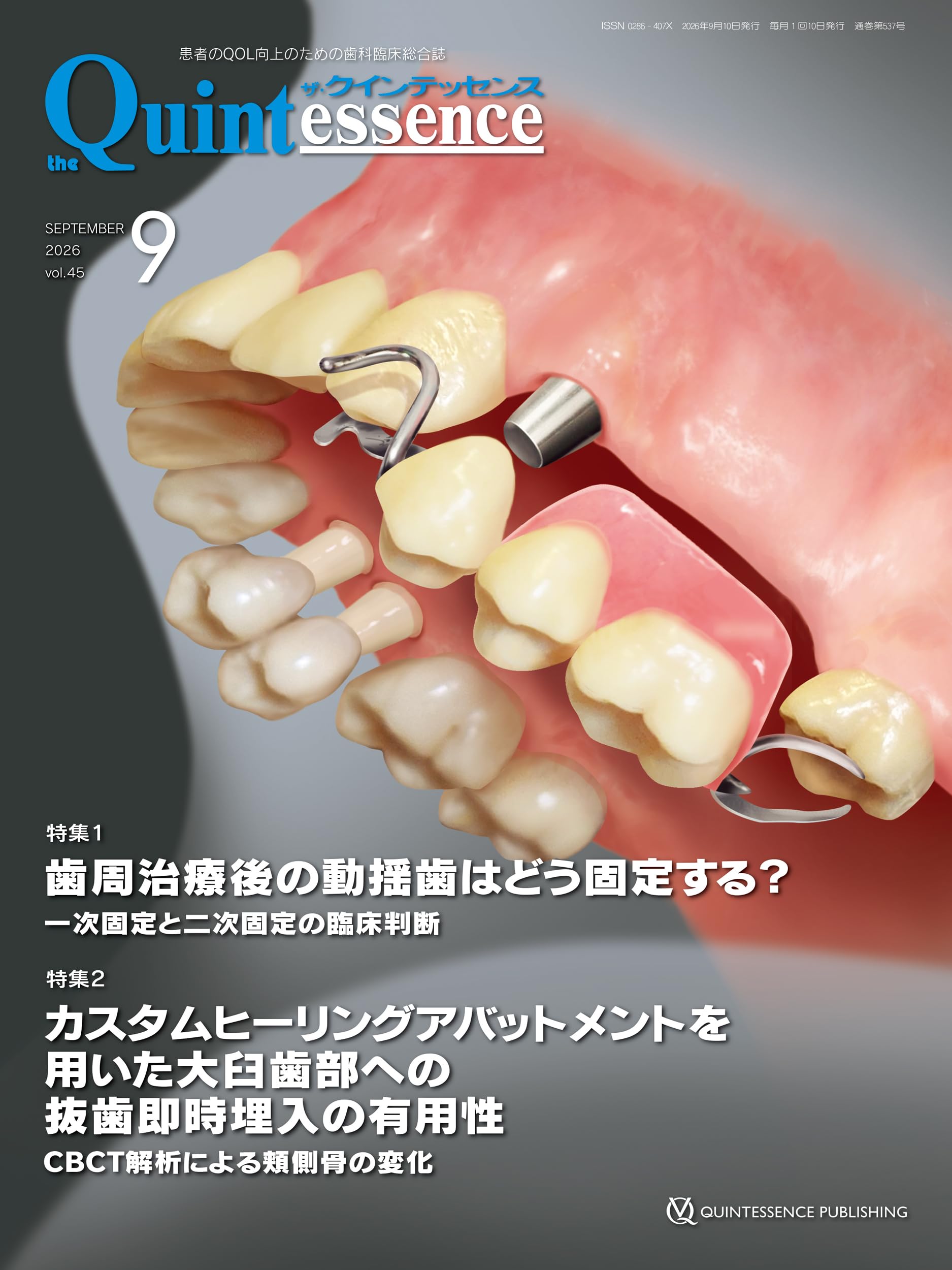歯科臨床総合誌 ザ・クインテッセンス 2026年 2・3・4・5・7月号 5冊 ザ・クインテッセンス 2026年9月号: 患者のQOL向上のための歯科臨床