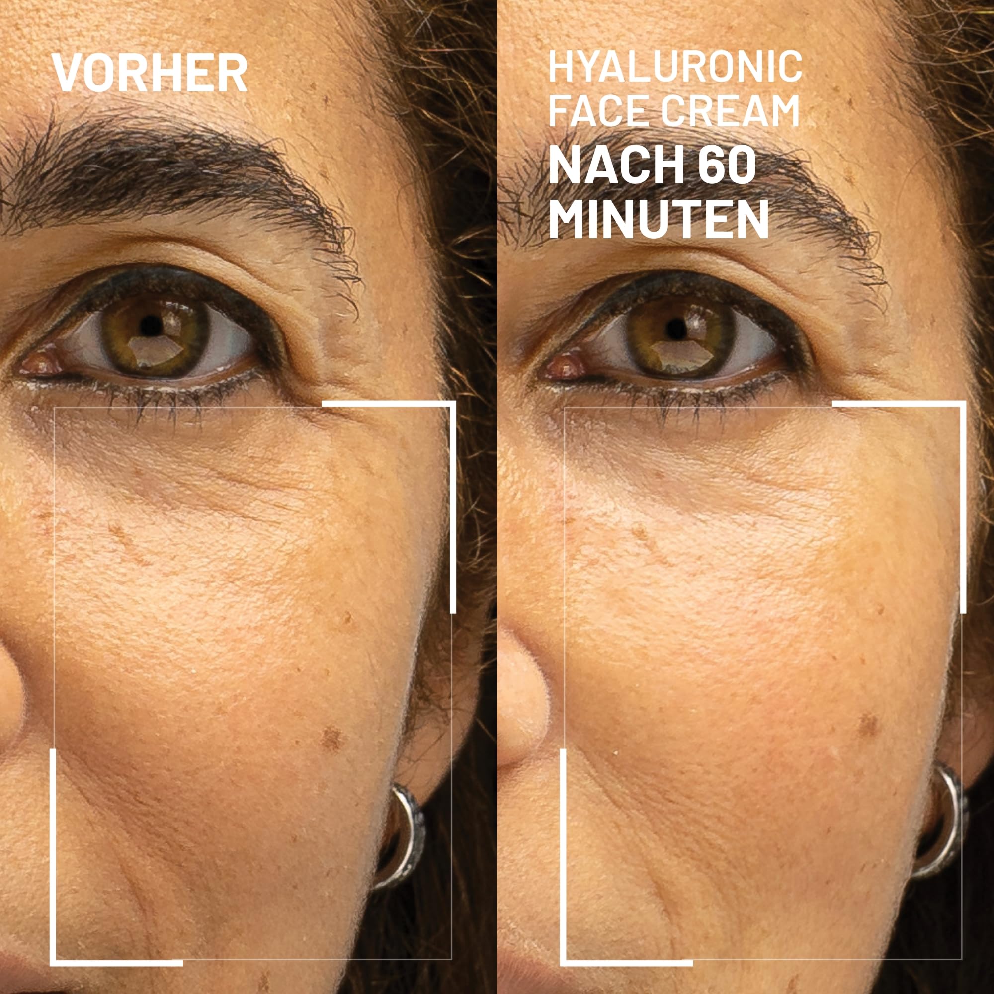 Dr. Brandt Needles No More Hyaluronic Face Cream - Lang anhaltende aufpolsternde Feuchtigkeitscreme für dehydrierte und trockene Haut - 50 g