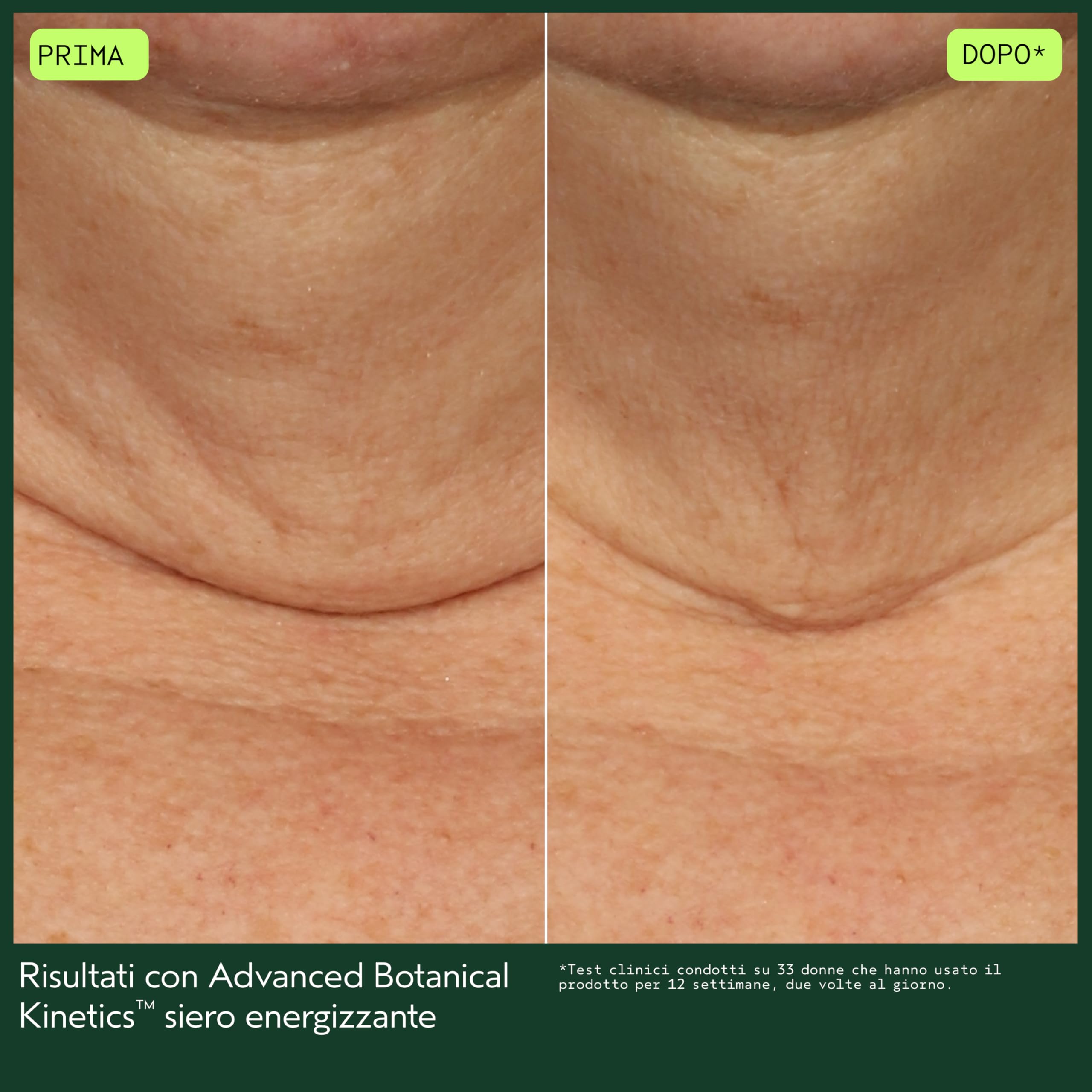 Aveda Advanced Botanical Kinetics™ Siero Rivitalizzante - Siero anti-età - Attenua rughe e linee sottili - Per tutti i tipi di pelle (30 ml)